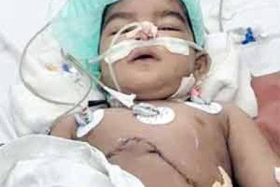 عثمانیہ جنرل ہاسپٹل میں کمسن بچہ کا جگر کی بیماری کا کامیاب علاج