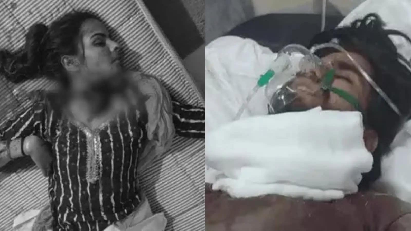 ہسپتال میں مریضہ کی حالت تشویشناک، وینٹی لیٹر پر ہے.