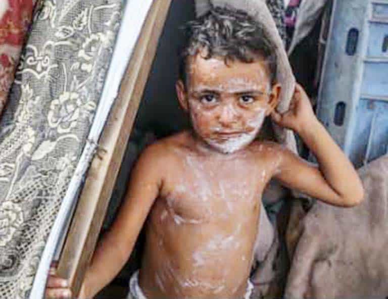 بچہ معصوم کی حالتِ تشویش، غریب اور بیمار بچے کی تصویر.