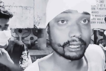 حیدرآباد کے شخص کو ’ترکالو‘ کہتے ہوئے مارا پیٹا گیا۔ پولیس  کا  فرقہ وارانہ  زاویہ سے انکار۔