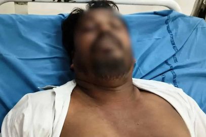 سی جے پی کے رضاکار عبدل کے والد بی جے پی کارکنوں کے حملے میں فوت ۔