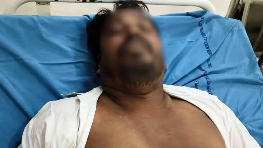 سی جے پی کے رضاکار عبدل کے والد بی جے پی کارکنوں کے حملے میں فوت ۔