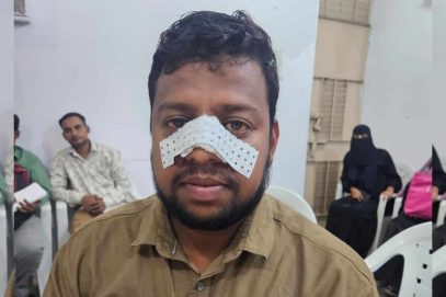 حیدرآباد: بیگم پیٹ کے قریب کیب ڈرائیور پر حملہ، ایم بی ٹی نے کارروائی کا مطالبہ کیا۔