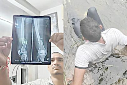 ویڈیو بنانے کا شوق، ڈیم میں چھلانگ لگانے والےنوجوان کی ٹانگیں ٹوٹ گئیں