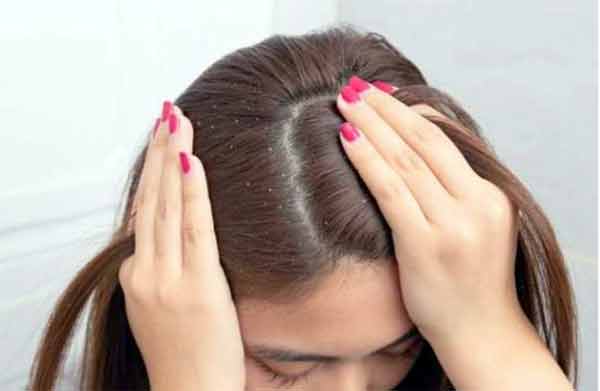 بالوں کا خشکی اور خشکی کا علاج، سر کی جلد کی دیکھ بھال.